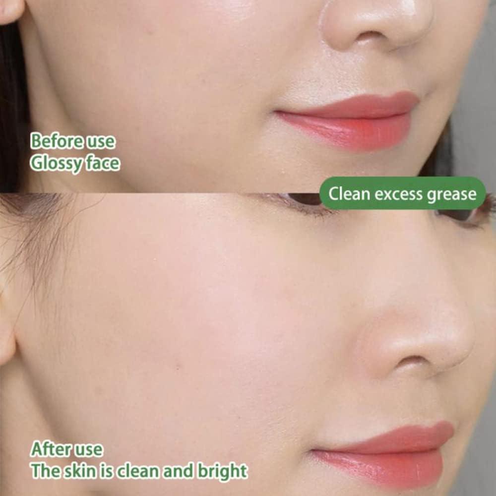 Pórustisztító És Aknékontroll Maszk