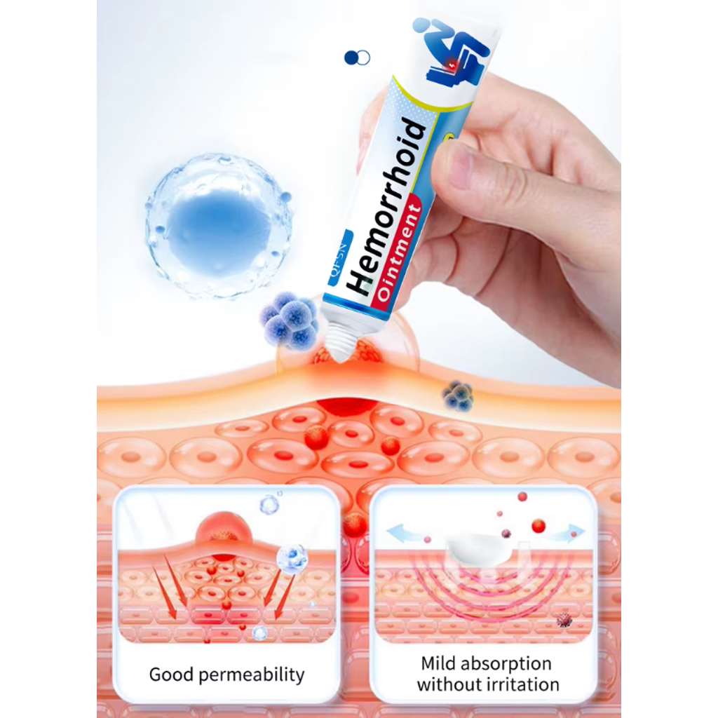 Természetes Gyógynövényes Krém Aranyér És Végbélsipoly Ellen